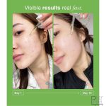 سرم آزلائیک اسید 10% و هیالورون آنوا 30 میل - Image 3