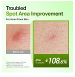 سرم آزلائیک اسید 10% و هیالورون آنوا 30 میل - Image 5