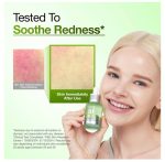 سرم آزلائیک اسید 10% و هیالورون آنوا 30 میل - Image 4
